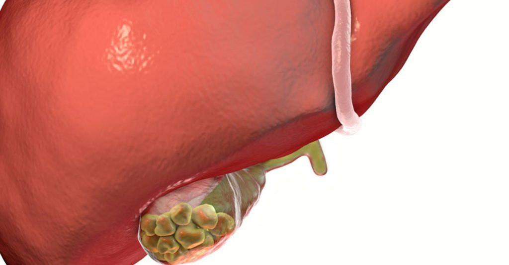 تأثیر استرس و عوامل روانی