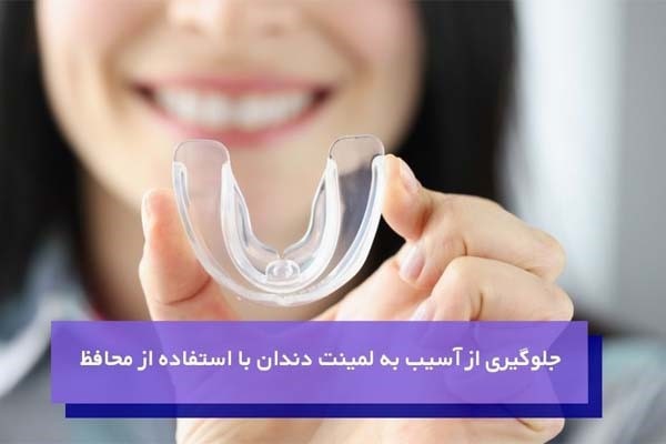 محافظ دهان برای مراقبت از لمینت دندان