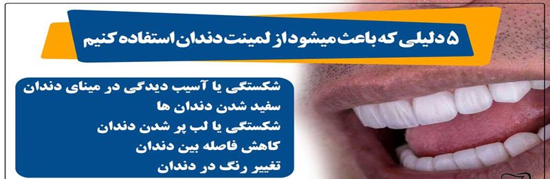 دلایل لمینت دندان