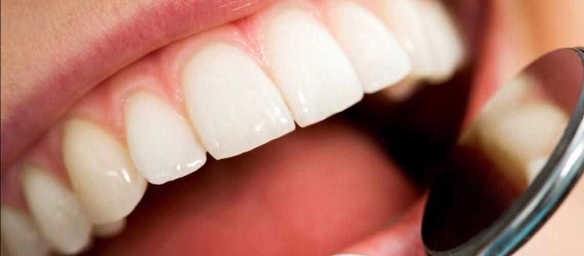 آیا جرمگیری دندان را خراب میکند؟