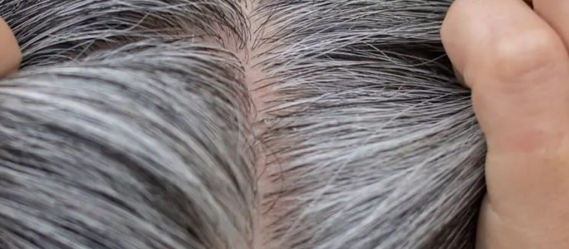 گرچه ژن‌ها نقش مهمی دارند، اما استرس اکسیداتیو و کمبودهای تغذیه‌ای می‌توانند روند پیر شدنِ سلول‌های رنگدانه‌سازِ فولیکول مو (ملانوسیت‌ها) را سرعت ببخشند.