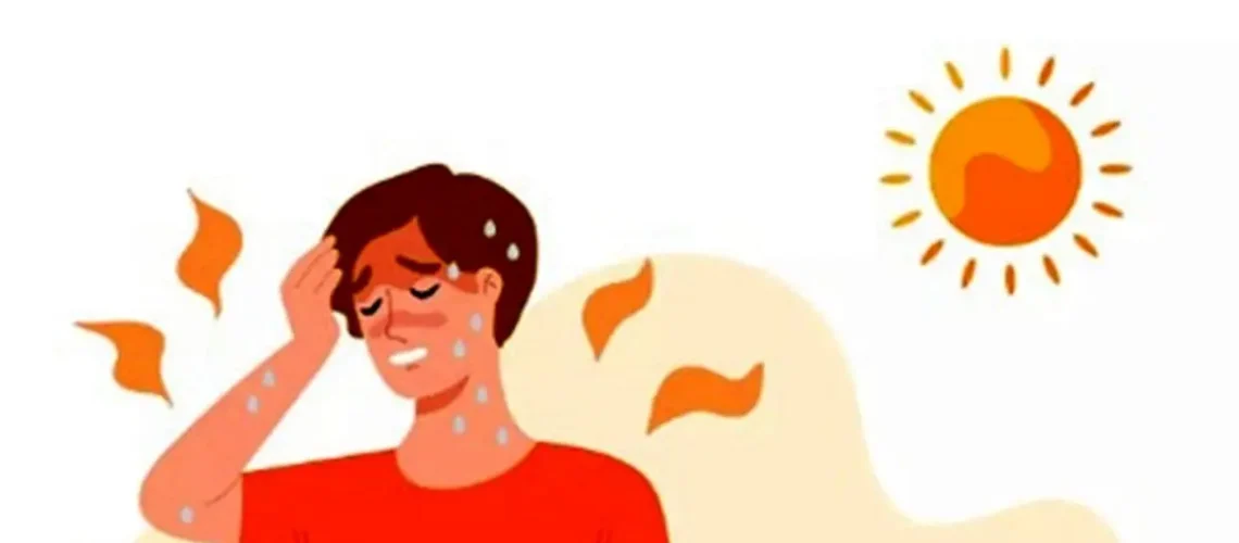 گرمازدگی
